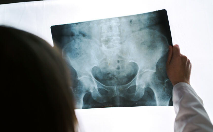Female doctor examining pelvis x-ray in hospital office
