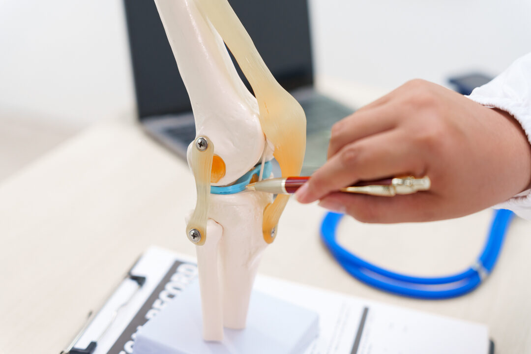 A doctor uses a knee joint model to demonstrate anatomy, diagnos