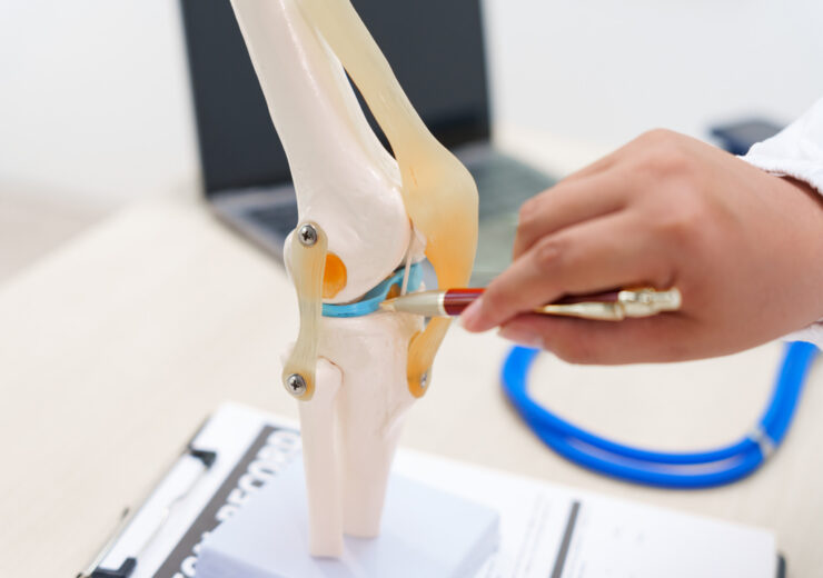 A doctor uses a knee joint model to demonstrate anatomy, diagnos