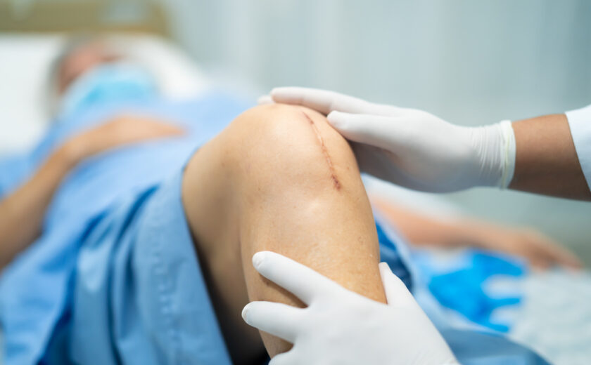 asian-elderly-woman-patient-show-her-scars-surgica-2026-03-20-03-27-03-utc