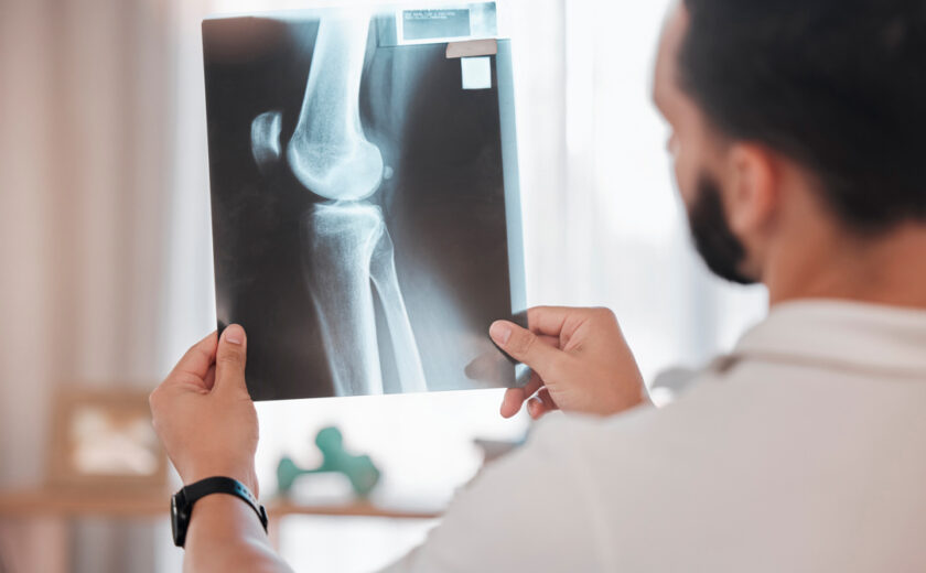 Health, x ray and physiotherapy, man physiotherapist check medic